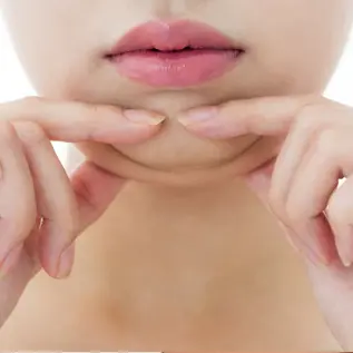 lipo de papada